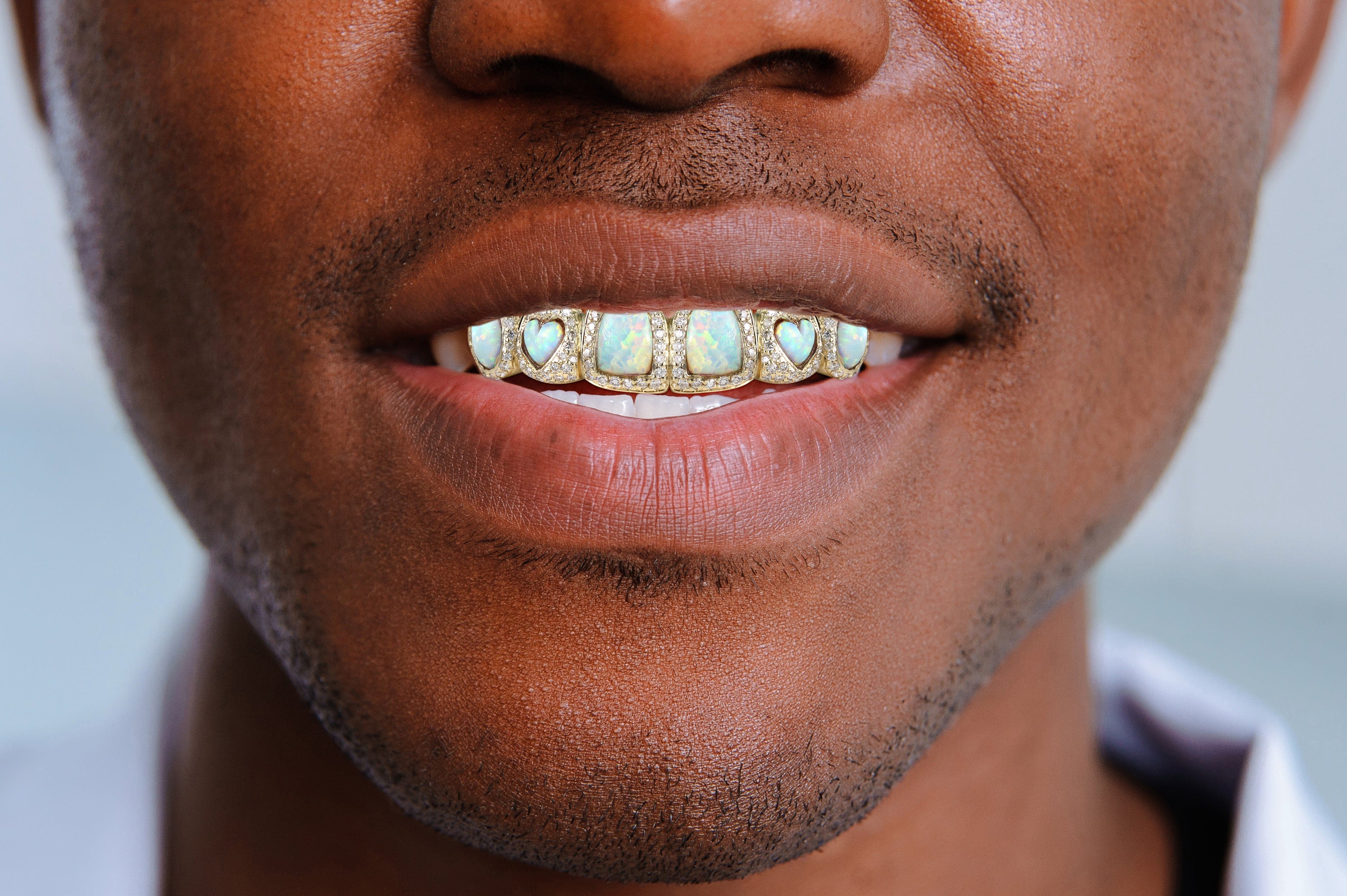 Gold 8 Teeth Diamond And Opal Grills - Image 4