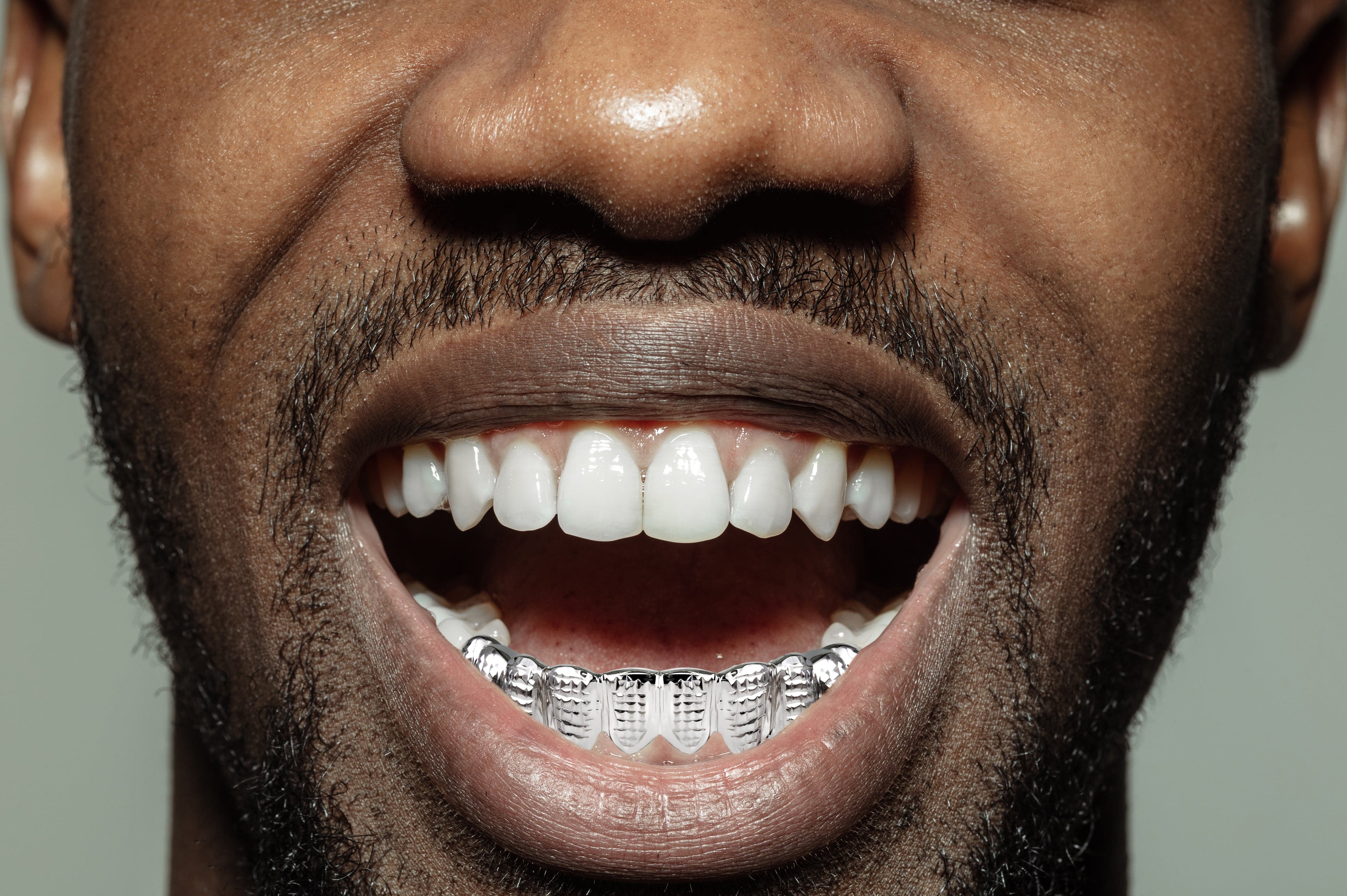 Gold 10 Teeth Diamond Cut Grillz - Image 4