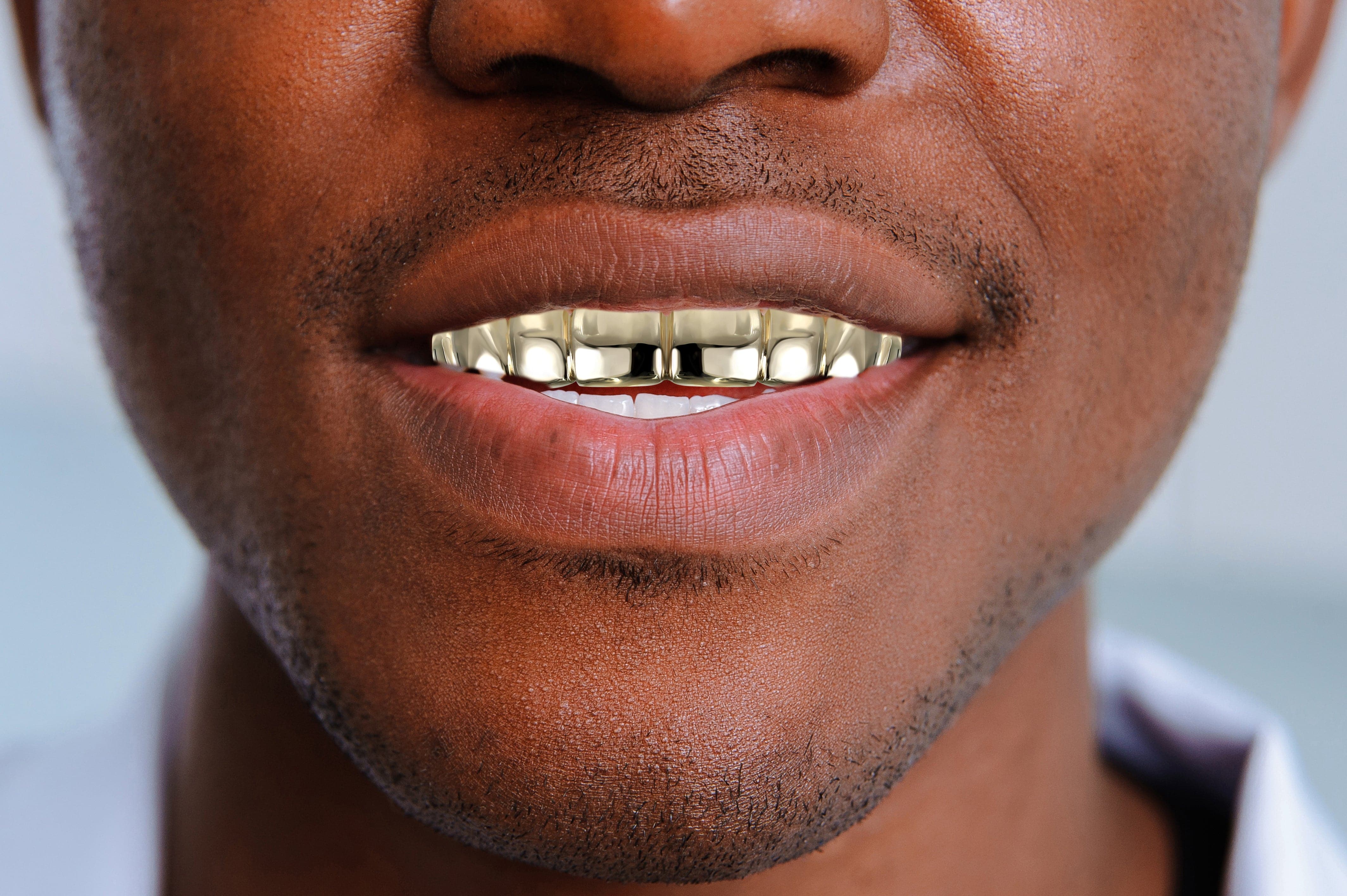 Gold 8 Teeth Gold Grills - Image 4